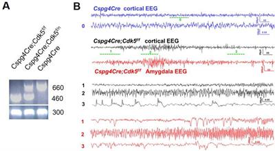 A novel animal model of spontaneous epilepsy: Cdk5 knockout in pericyte-specific mice